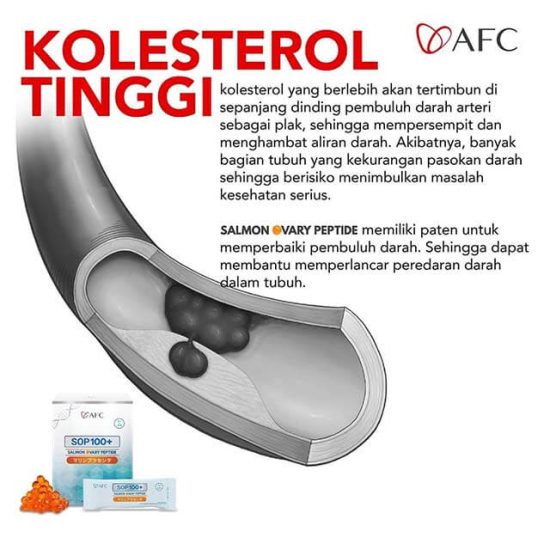 tanda masalah pada Kolesterol