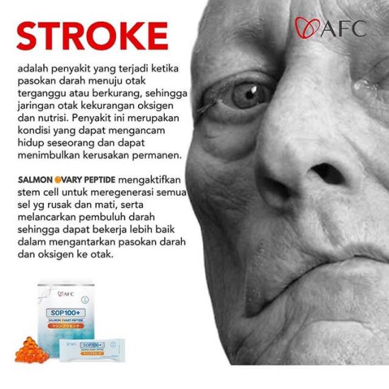 tanda masalah pada Sroke